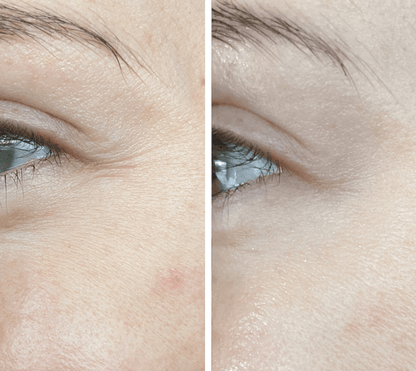 Maska Prestige DermaLight