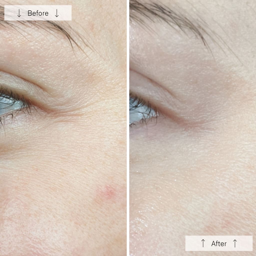 Maska Prestige DermaLight